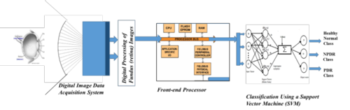diagram of AUTOMATED COMPUTER CLASSIFIER OF DIABETIC RETINOPATHY